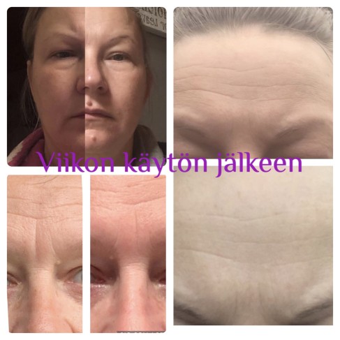 Marikan Hiusyksiöstä LumiSpa kasvojen syväpuhdistus ja 10min hieronta